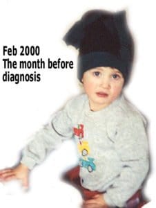 before diabetes