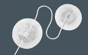 TruSteel infusion set for insulin pump