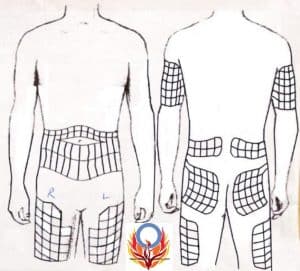 site rotation map for injection and insulin pump therapy