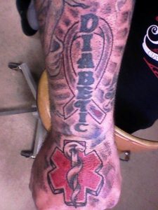 diabetic tattoo