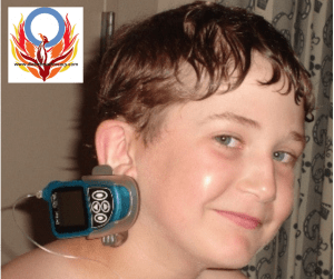 wearing an insulin pump clip Diabetes Advocacy