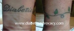 diabetic wrist tattoo Diabetes Advocacy