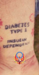 diabetes tattoo