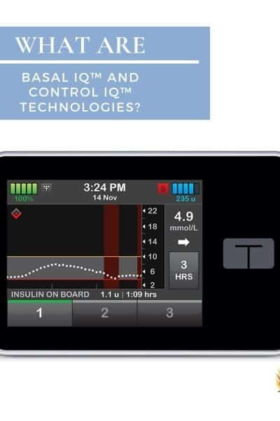Basal IQ and Control IQ technologies