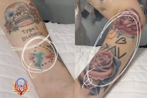 diabetes tattoo