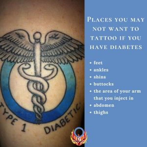 where to place a tattoo when you have diabetes Diabetes Advocacy