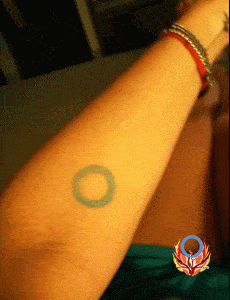 blue circle tattoo Diabetes Advocacy